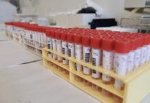 Covid, 189 positivi a Monopoli in una settimana. La Asl: “Forte aumento delle somministrazioni di vaccini”
