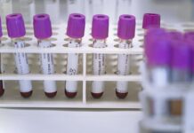 Il virus corre veloce in Puglia, oggi 12.414 nuovi positivi. Dieci le vittime
