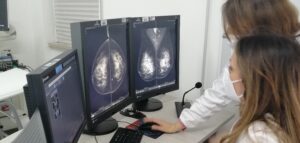 mammografia 1