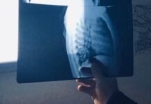 Lettera aperta ad Emiliano: “Istituire il servizio di radiologia domiciliare”