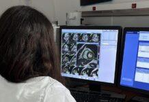 Tac e risonanze anche la domenica per abbattere le liste di attesa